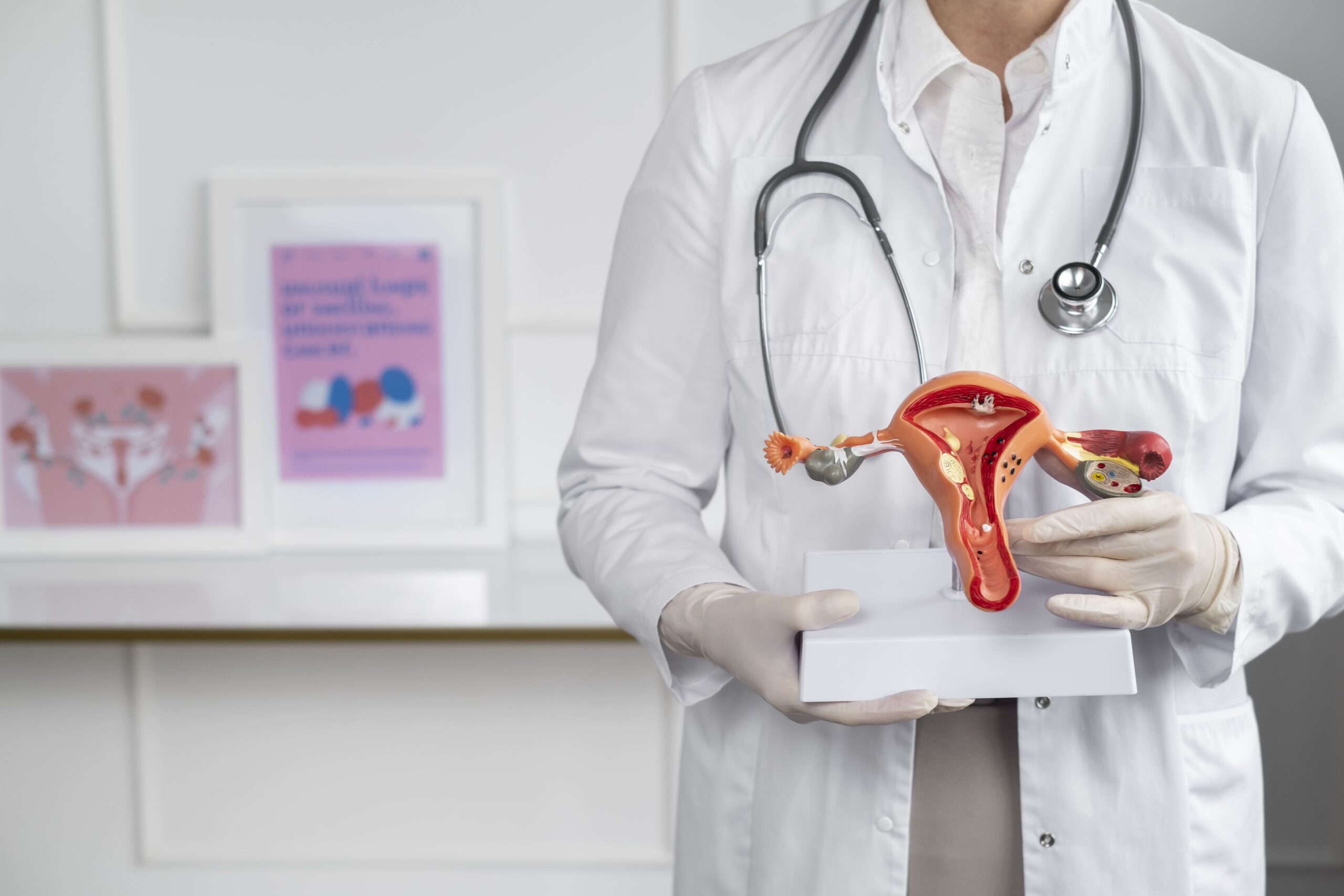 PCOS: Simptomat, shkaqet, trajtimi