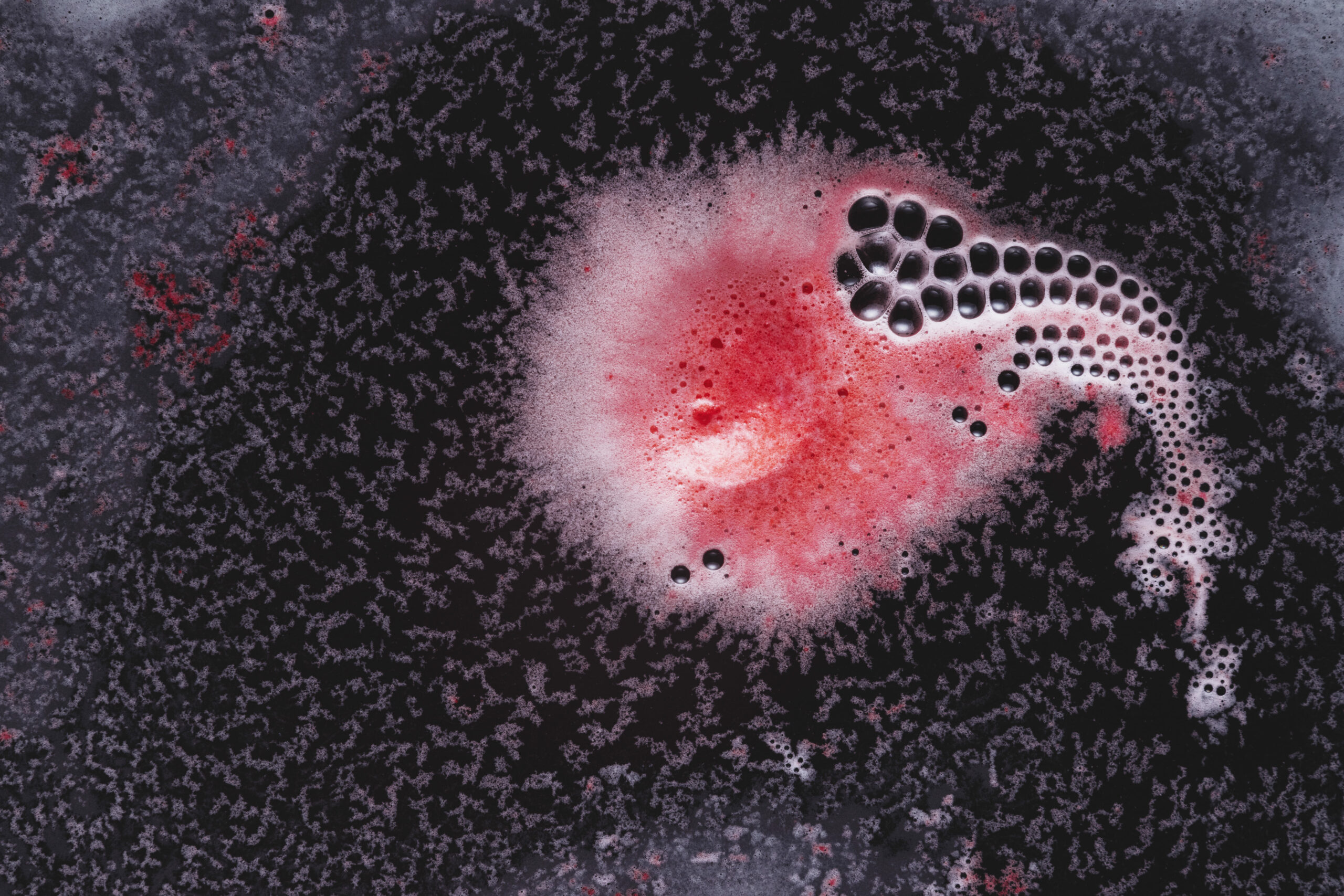 Infeksionet Stafilokok: Diagnostikimi dhe trajtimi