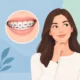 Aparat dentar apo aligner: cili ju përshtatet?